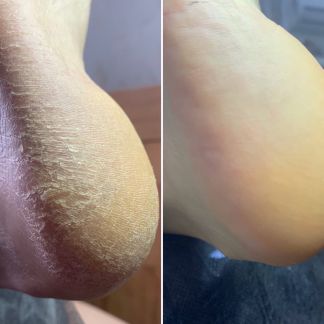 Маникюр Педикюр smart  Армавир