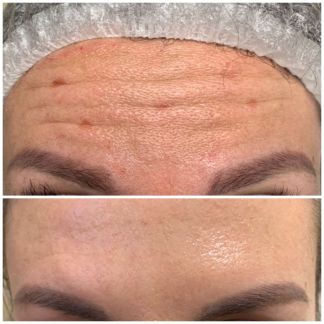 Услуги Косметолога  Армавир