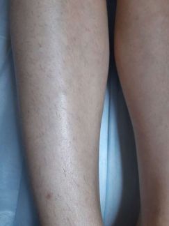 Депиляция  Армавир