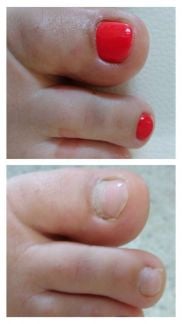 Педикюр  Армавир