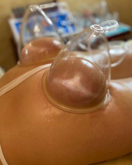 Вакуумно-роликовый массаж, миостимуляция  Армавир