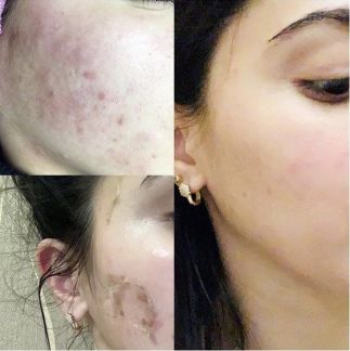 Косметолог Красная поляна  Армавир