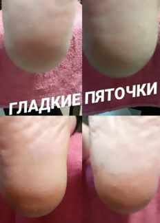 Педикюр  Армавир