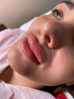 Косметология, перманентный Макияж, лазерная эпиляц  Армавир