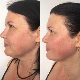 Массаж лица FaceSculpting  Армавир