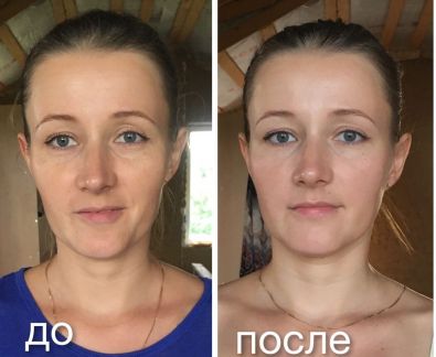 Омоложение лица за 4 сеанса, остеопатия  Армавир